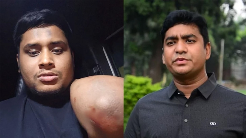 হাসনাতের গড়িতে হামলার ঘটনায় ছাত্রদল সম্পাদক নাছিরের স্ট্যাটাস