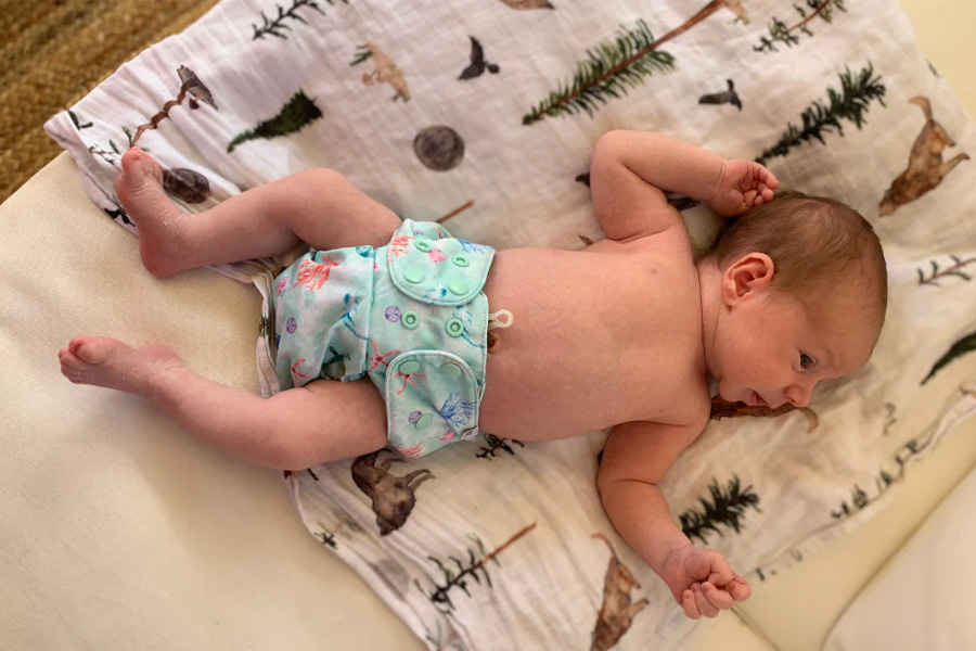 শিশুর ত্বকের সমস্যা বাড়তে পারে সারাদিন ডায়াপার পরালে