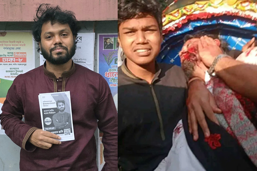 গুলিবিদ্ধ হাদি এখন কোমায় আছেন : চিকিৎসক