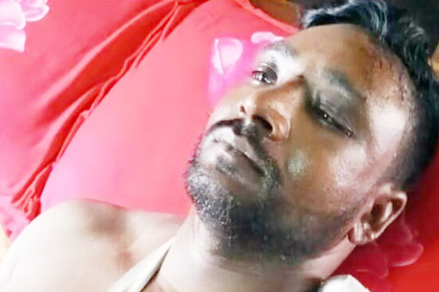 ভয়াবহ দুর্ঘটনায় লাইটম্যান সহকারীর হাত কাটা