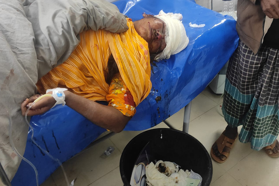 নবাবগঞ্জে স্কুল শিক্ষার্থীর ওপর ধারালো অস্ত্র দিয়ে হামলা