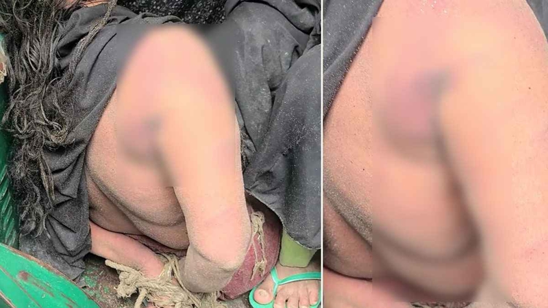 নারী নেত্রীকে বিবস্ত্র করে নির্যাতনের অভিযোগ