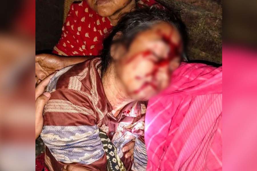 ভাঙ্গুড়ায় ভাড়াটিয়া বিরোধে গৃহবধূকে মারধর, থানায় অভিযোগ
