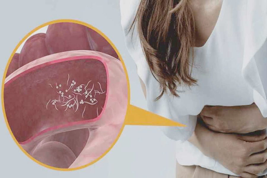 শরীরে কৃমি বাসা বাঁধার ৫ লক্ষণ এবং প্রতিরোধের উপায়