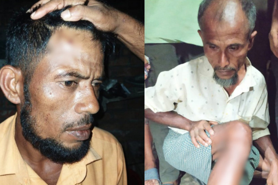 বাঁশখালীতে লবণের মাঠ দখল নিয়ে গোলাগুলি, ৪জন আহত