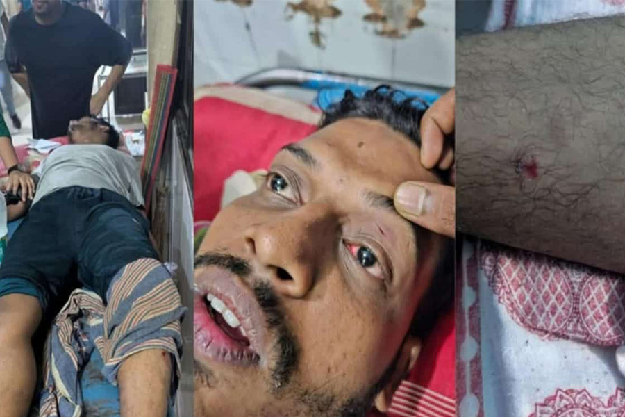 ফিক্সড-মিল নিয়ে ইবি শিক্ষার্থীদের মারামারি, আহত ৪
