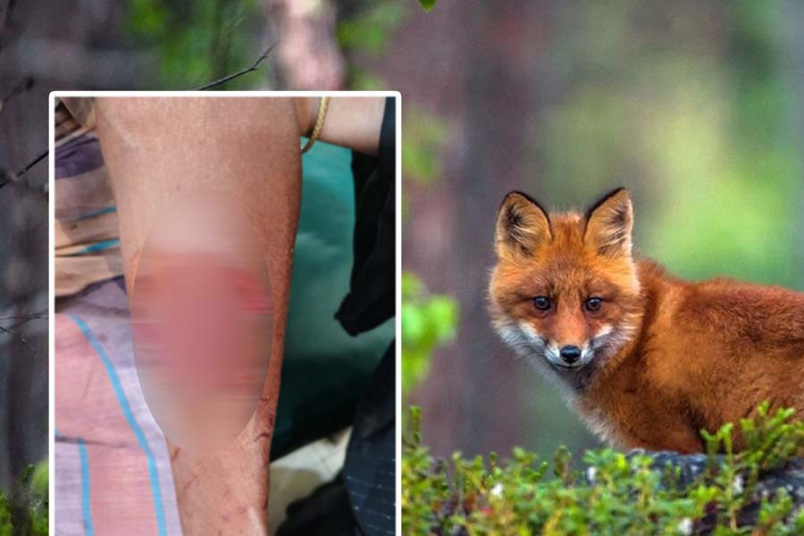 মধুপুরে পাগলা শিয়ালের কামড়ে অন্তত ২০ জন আহত