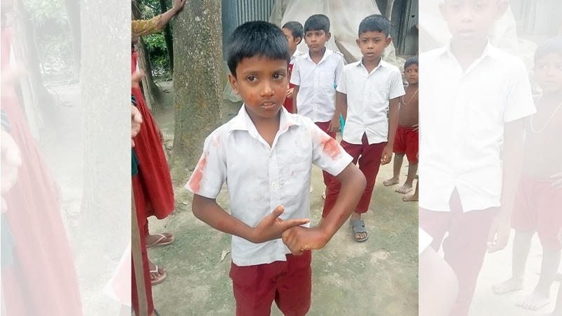তুচ্ছ ঘটনায় শিশু শিক্ষার্থীর নাক ফাটালেন সহকারি শিক্ষক!